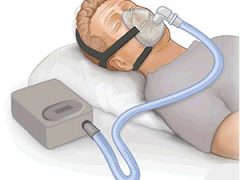 CPAP apparaat op vakantie gebruiken